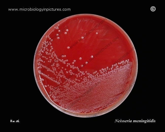 Neisseria meningitidis on blood agar plate neisseria meningitidis on agar with sheep blood
